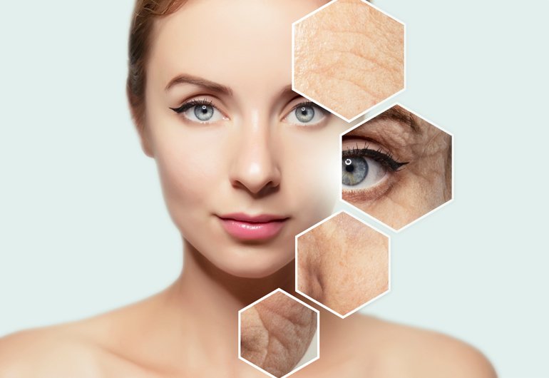 Anti-Wrinkle Injections in Dubai